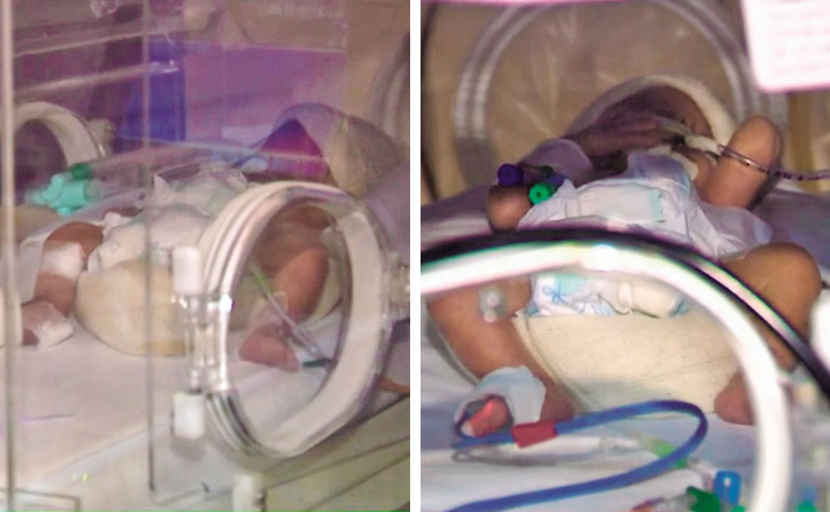 As crianças nasceram saudáveis e continuam internadas no Hospital Nossa Senhora do Rocio.