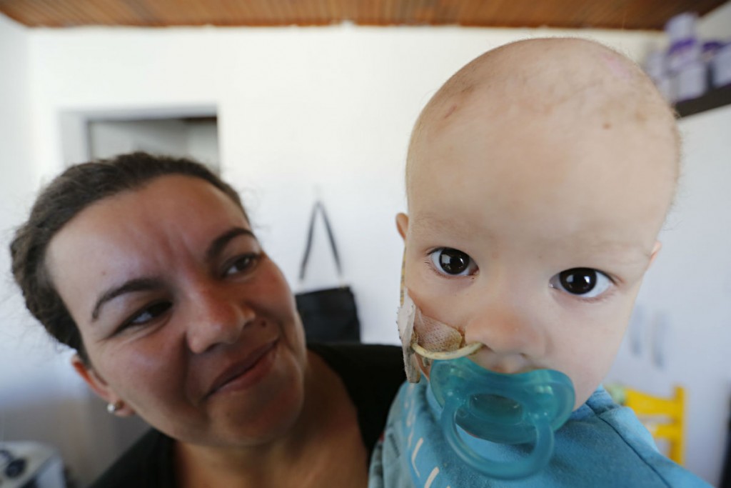 Com câncer cerebral, João Lucca faz quimioterapia. Foto: Felipe Rosa