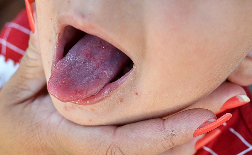 Foto: Marco Charneski.