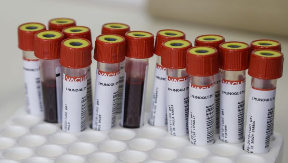 Teste coronavírus covid-19