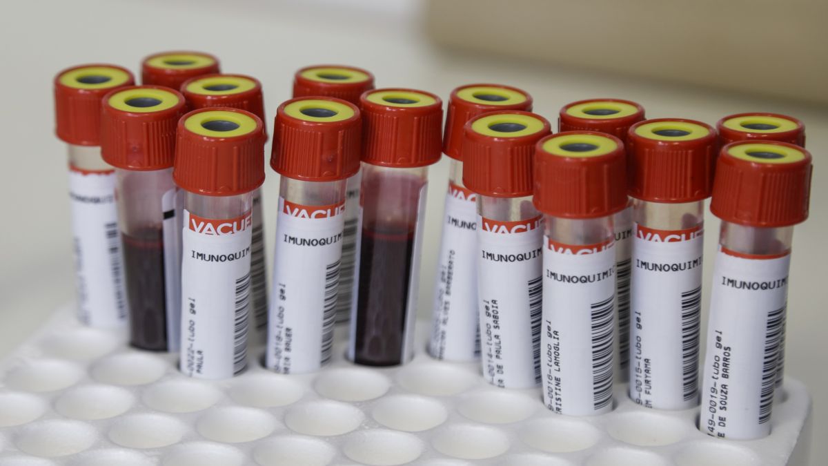 Teste coronavírus covid-19