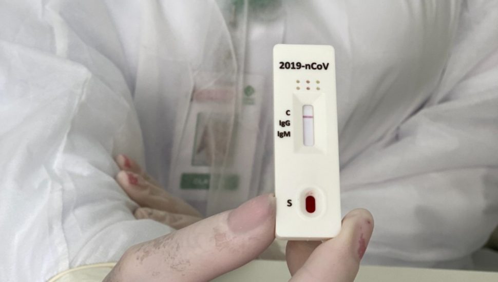 teste covid
