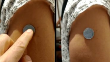 moeda braço vacina covid-19