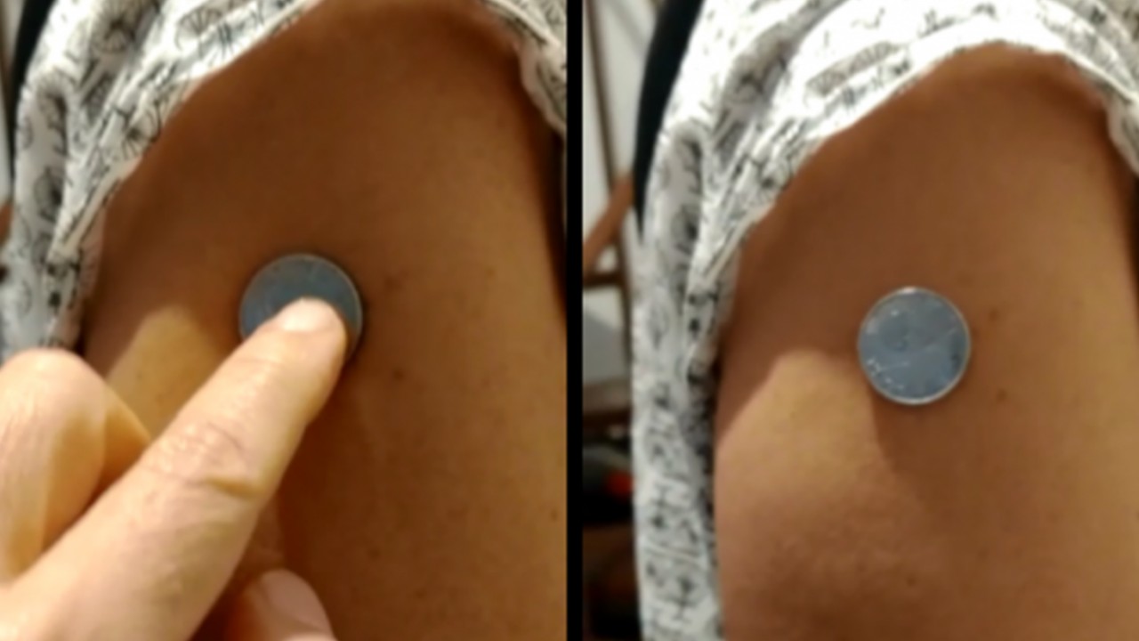 moeda braço vacina covid-19