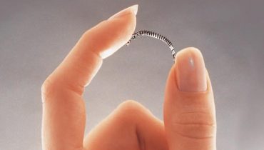 essure bayer