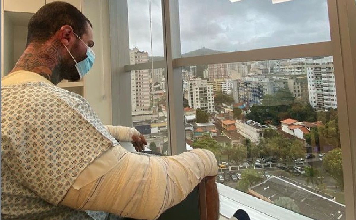 Fisiculturista sofreu um acidente e teve grande parte do corpo queimado.