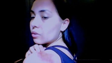 Além do trauma por causa do assédio, Andressa ficou com ferimentos pelo corpo.