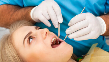 Qual é o dente siso? Confira tudo que você precisa saber sobre ele!