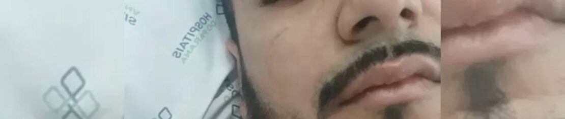 "Botei a mão na frente, a bala pegou no meu relógio, relou no punho, e o estilhaço do relógio voou tudo no meu olho", relatou Eduardo.