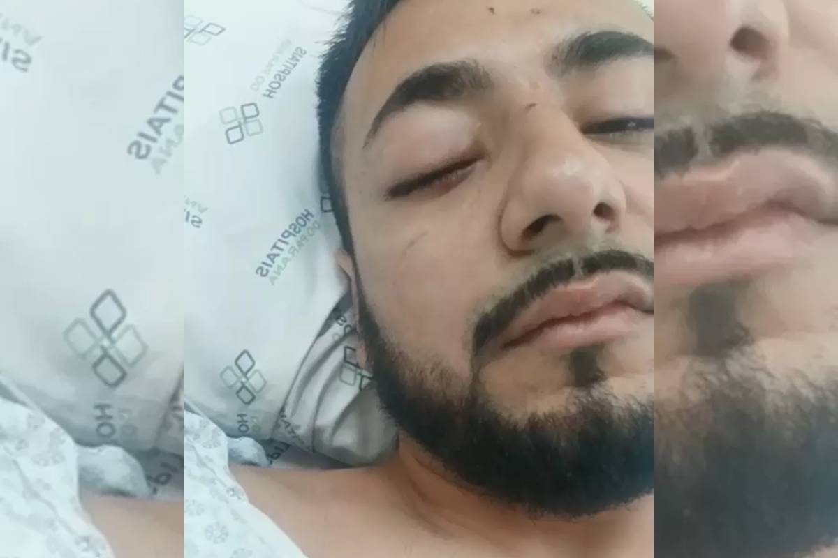 "Botei a mão na frente, a bala pegou no meu relógio, relou no punho, e o estilhaço do relógio voou tudo no meu olho", relatou Eduardo.