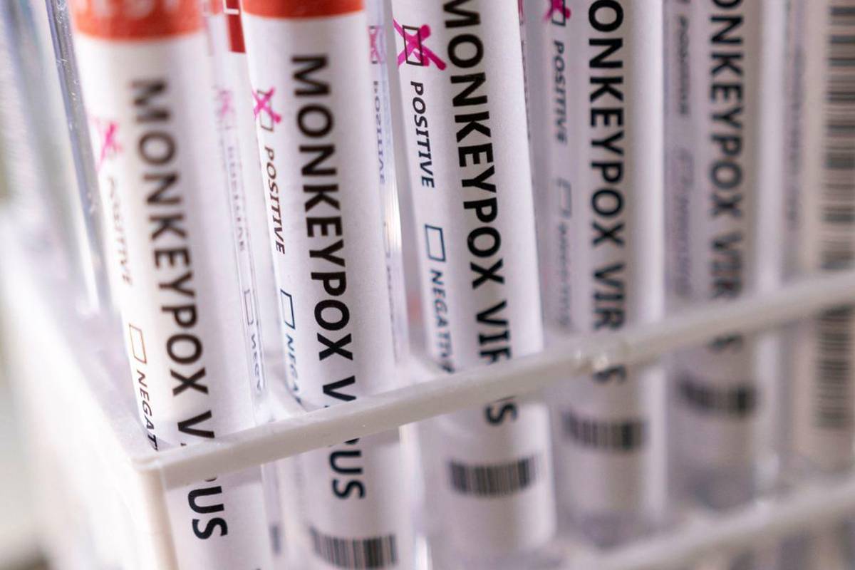 O caso em Curitiba era suspeito e foi confirmado após exames clínicos.