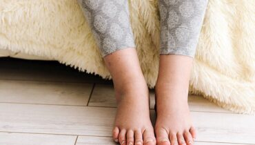 75% dos brasileiros ficam com pés ou tornozelos inchados