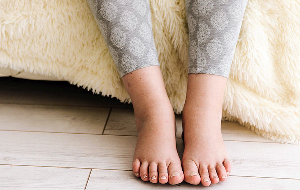 75% dos brasileiros ficam com pés ou tornozelos inchados