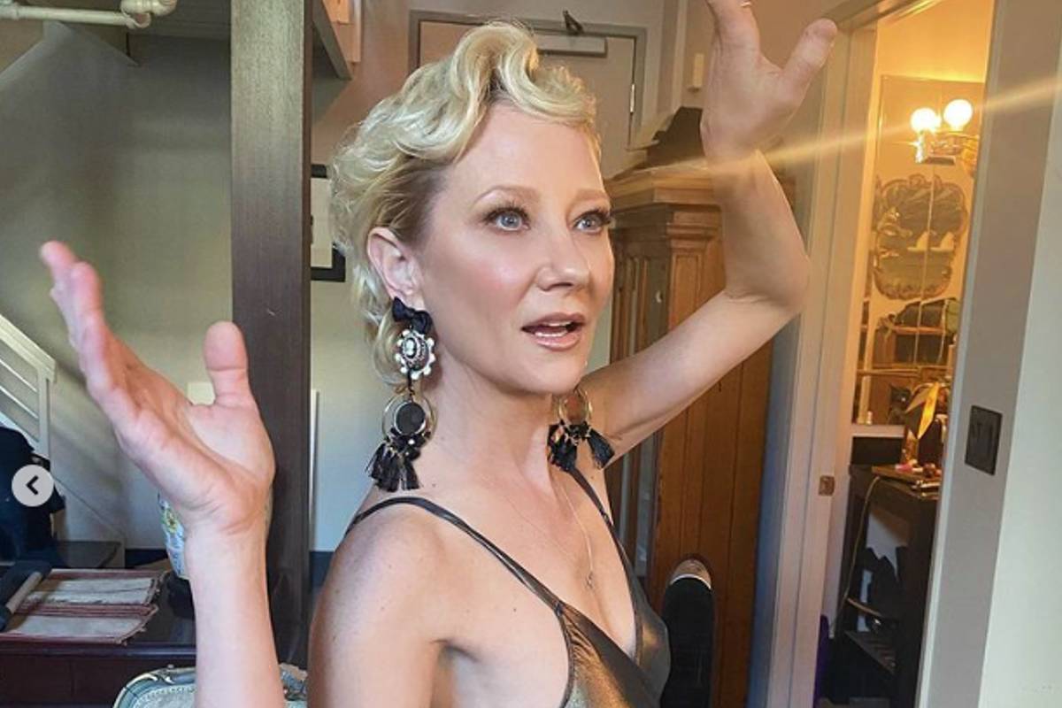 Anne Heche em coma
