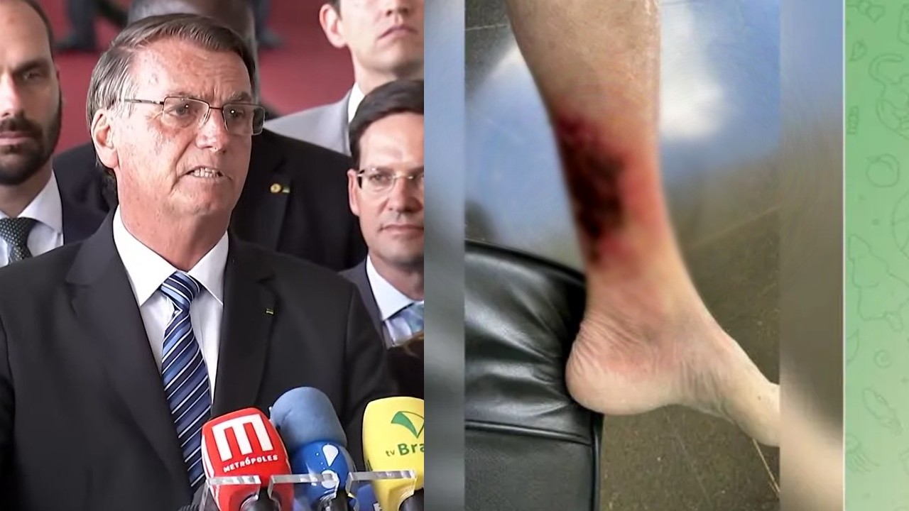 bolsonaro ferida perna