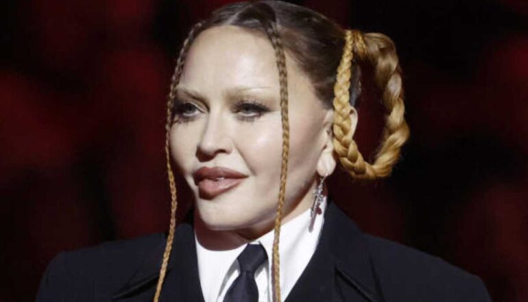 Madonna "desarmonização facial"