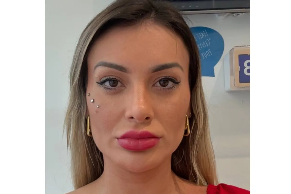 Andressa Urach antes da cirurgia para mudar a cor dos olhos.