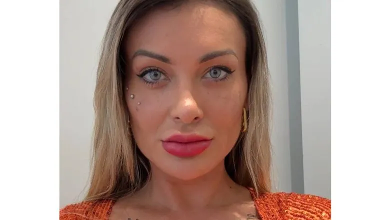 Andressa Urach depois da cirurgia para mudar a cor dos olhos, arrependida.