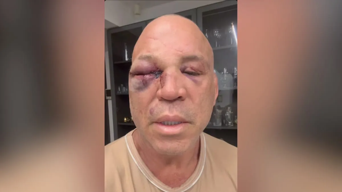 Wanderlei Silva após luta com que terminou em confusão.