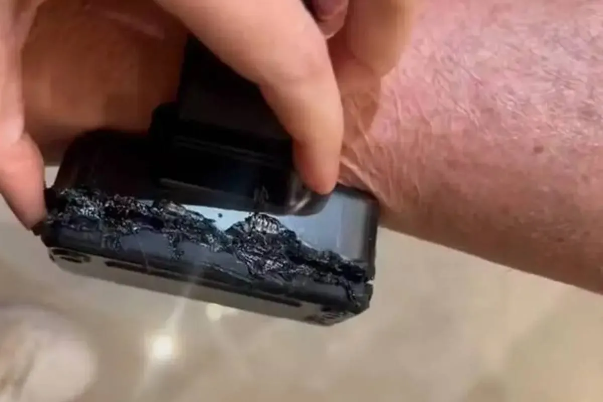 Imagem mostra a tornozeleira de Jair Bolsonaro queimada com ferro de solda