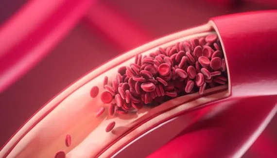 Como o calor e as viagens podem aumentar o risco de trombose no fim de ano