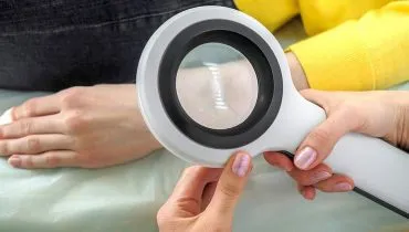 Hospital faz exame grátis em manchas e pintas pra diagnosticar câncer em Curitiba