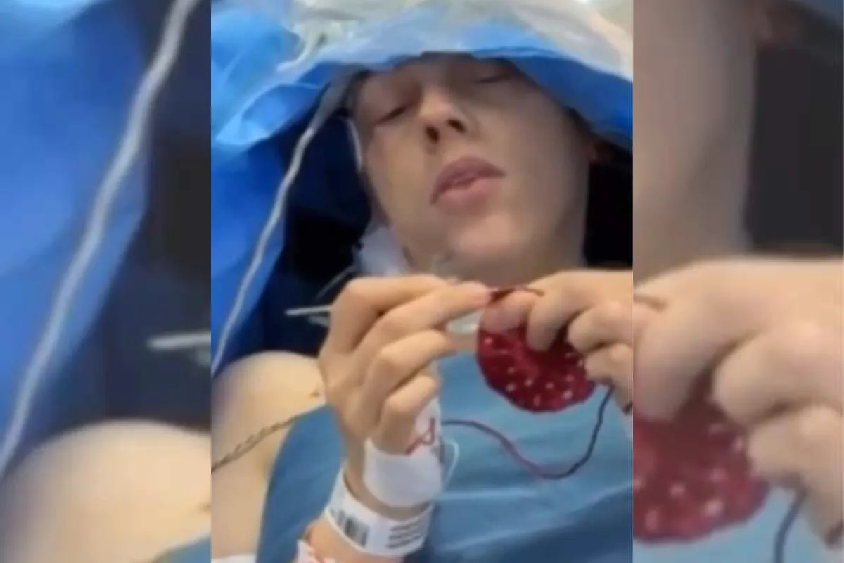 Imagem mostra uma mulher fazendo crochê enquanto passa por uma delicada cirurgia.