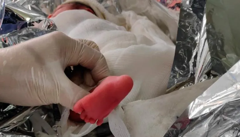 Operação inédita salva bebê com apenas 5 horas de vida no PR