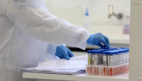 Paraná registra primeiro caso de mpox em 2026 na região da tríplice fronteira