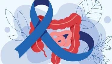 A atividade física é uma aliada contra o câncer colorretal (Imagem: Nasly creativity | Shutterstock)