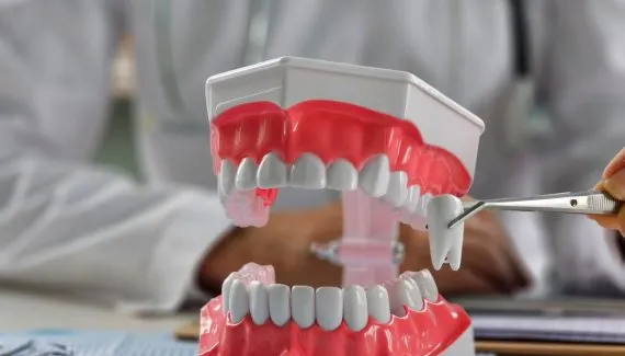 Dente do siso: entenda por que ele existe e quando a extração é necessária