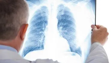 imagem mostra um médico analisando um raio-x do pulmão