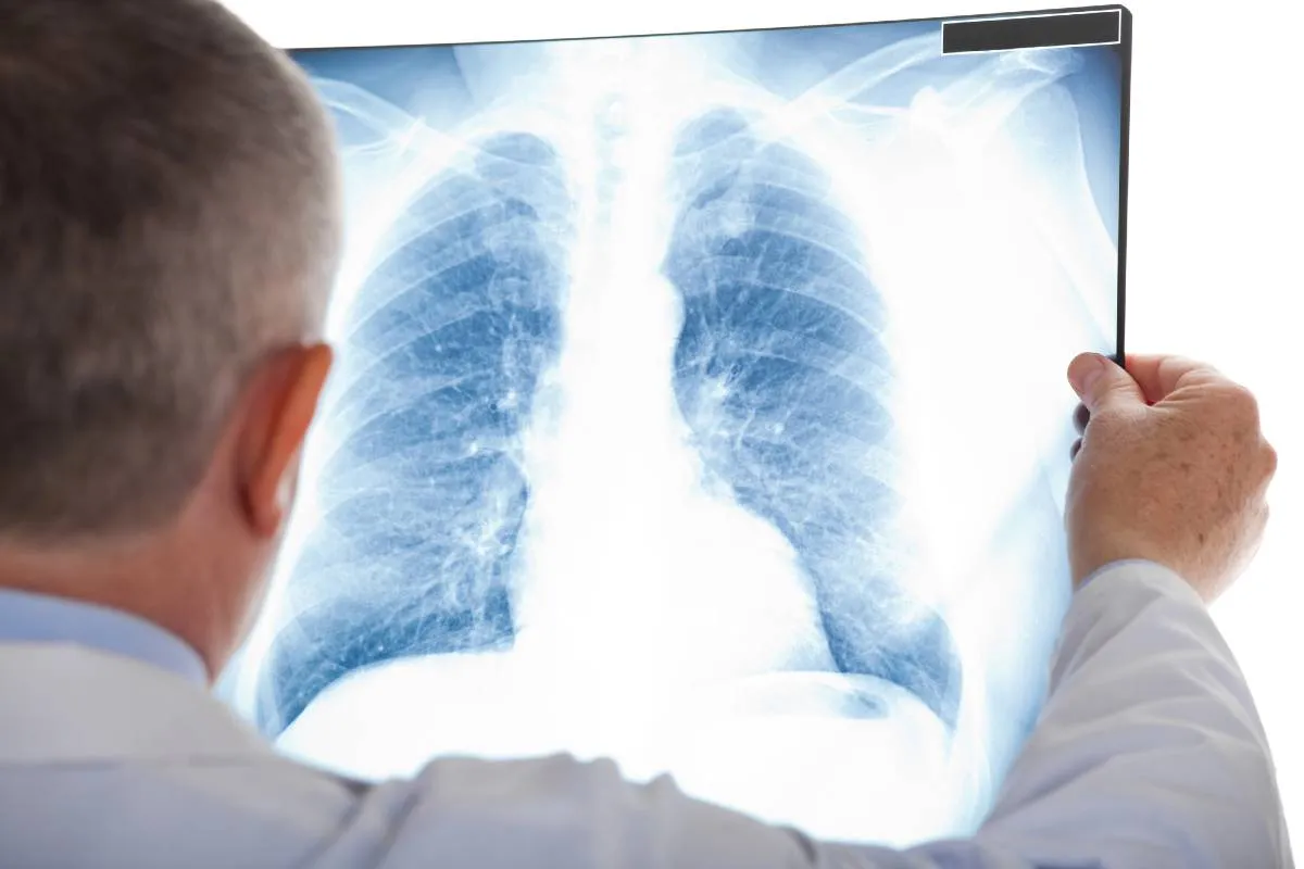 imagem mostra um médico analisando um raio-x do pulmão