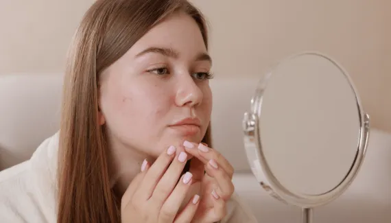 Sua pele piorou depois do skincare? 5 erros que podem causar oleosidade, irritação e espinhas