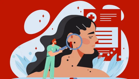 Veja os sinais que podem indicar câncer de pele e quando procurar um dermatologista