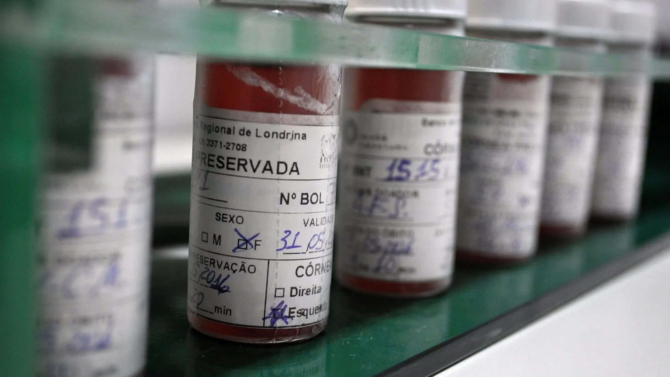 Doação de tecidos pode devolver a visão e tratar queimaduras no Paraná