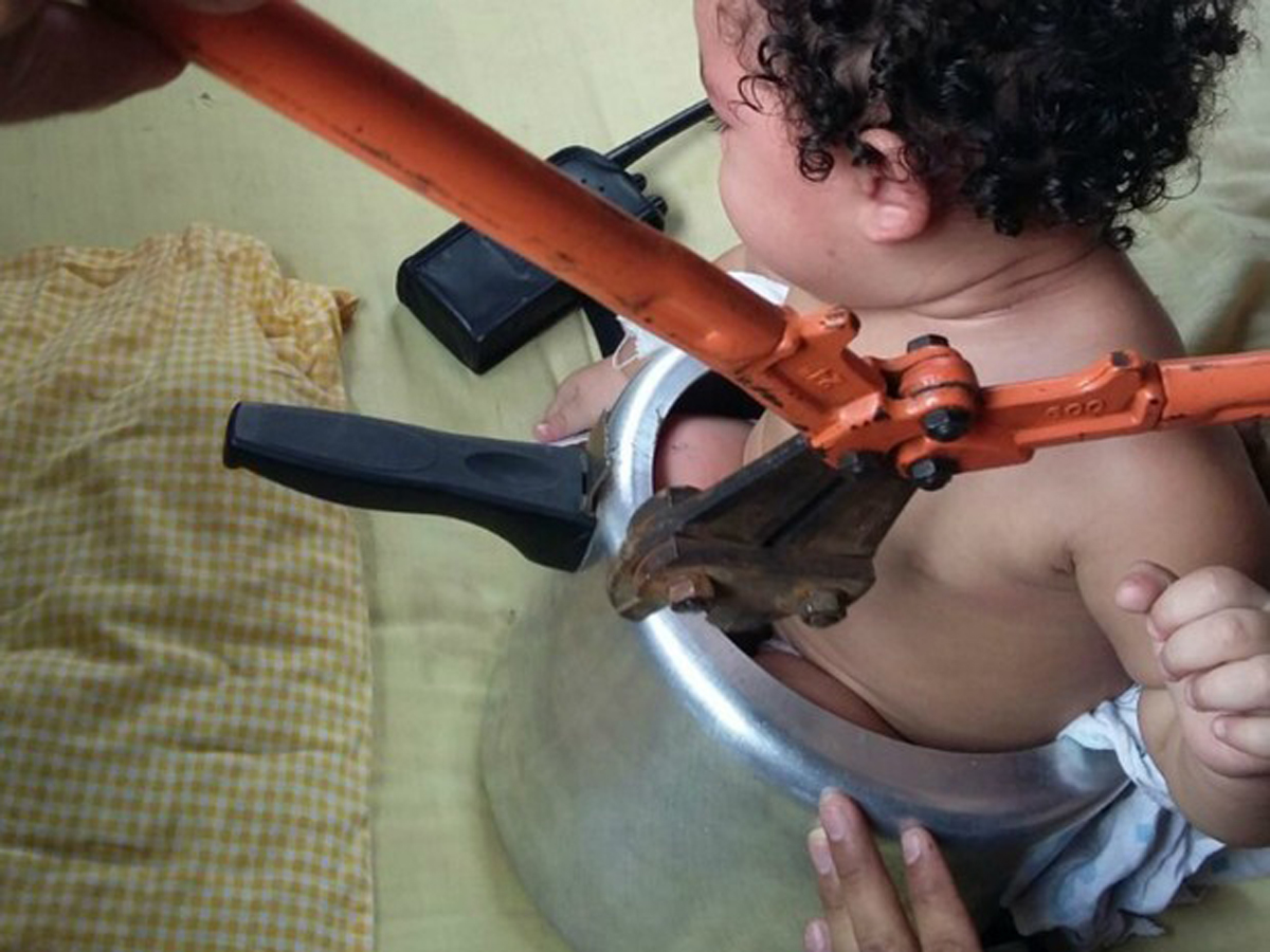 Criança ficou entalada dentro de panela de pressão no Acre. foto: Divulgação / Bombeiros AC