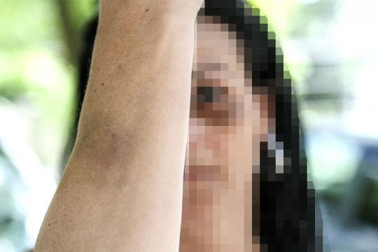 S.G. foi agredida pelo namorado, lutador de MMA (Foto: Rodrigo Felix Leal). 