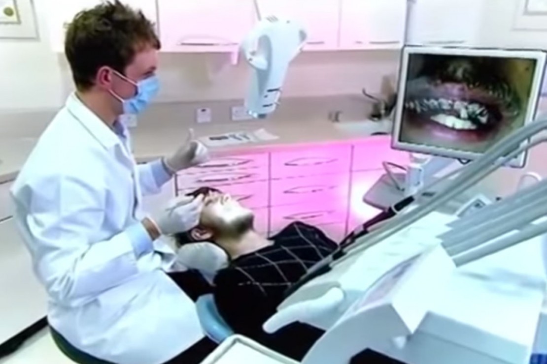 Jovem precisa arrancar 11 dentes após passar 20 anos sem escová-los