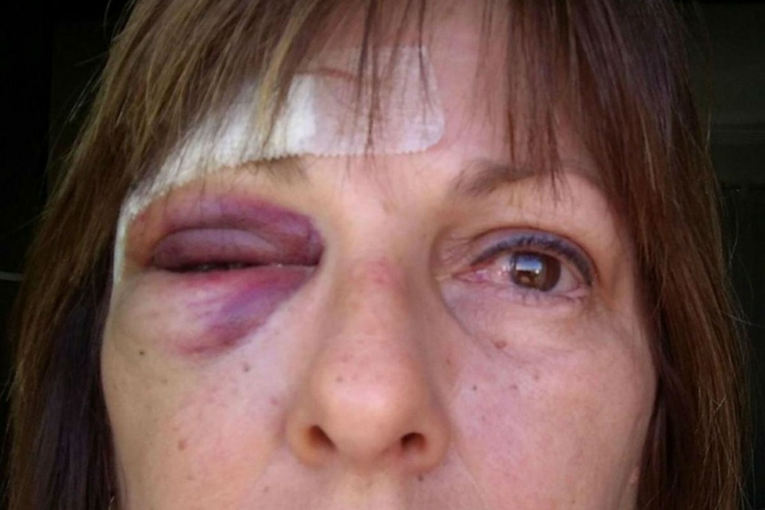 Marcia Friggi: recuperação após socos em escola. Reprodução/Facebook