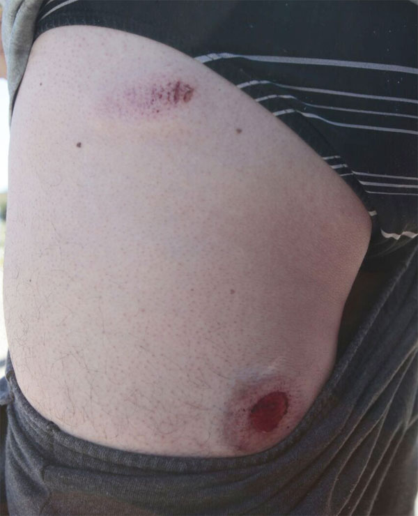 No momento da ação, tiros de borracha foram disparados contra alguns moradores. Foto: Daniel Caron.