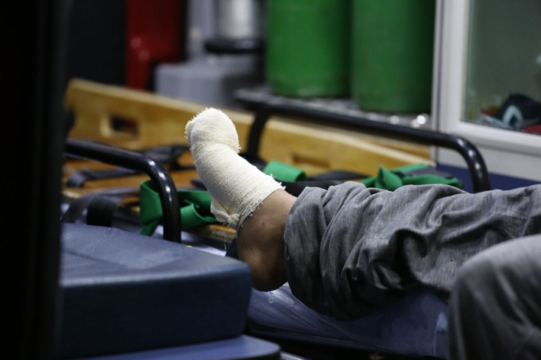 Suspeito de participar de crime perdeu o dedo do pé em acidente. Foto: Marco Charneski