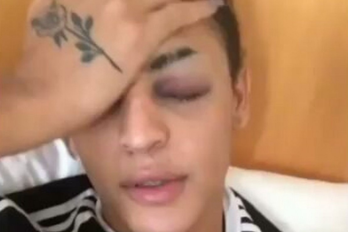 Foto: Reprodução/Instagram