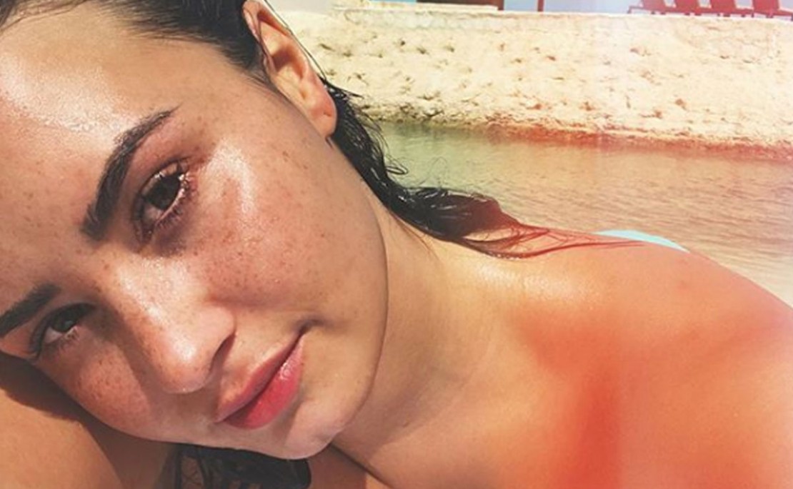 Demi Lovato posta textão falando com os fãs a respeito da sua overdose. Foto: Reprodução/instagram.