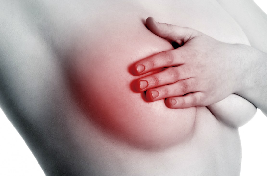 Corpo dá sinais e o melhor a fazer é uma mamografia.