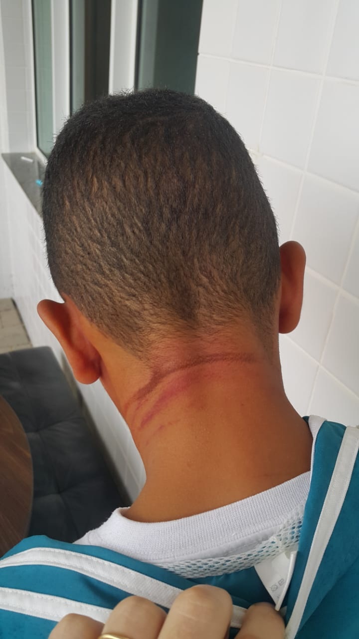 Além de ser espancado, menino teve pescoço amarrado com uma corda. Foto: Divulgação/Polícia Civil