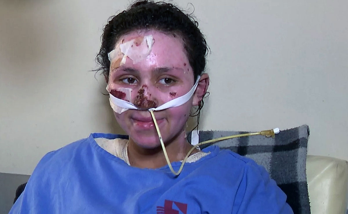 Jaqueline foi socorrida em estado grave e levada ao hospital, onde ficou internada, mas não resistiu. Foto: Reprodução/RPCTV.