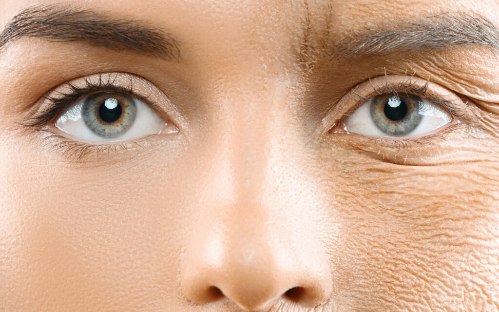 envelhecimento precoce saiba como evitar sem cirurgia