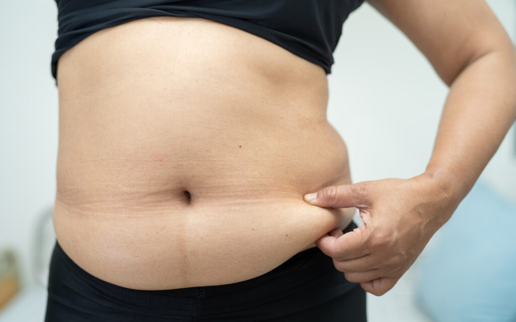 efeito sanfona como acabar