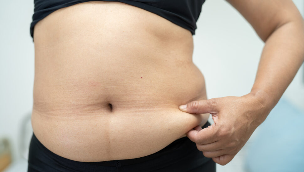 efeito sanfona como acabar